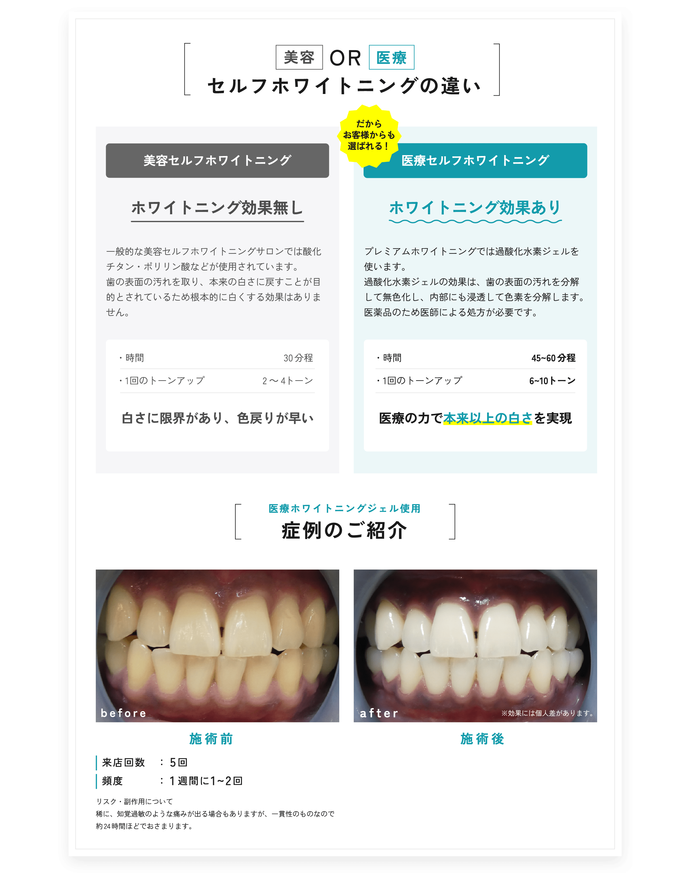 美容or医療 セルフホワイトニングの違い